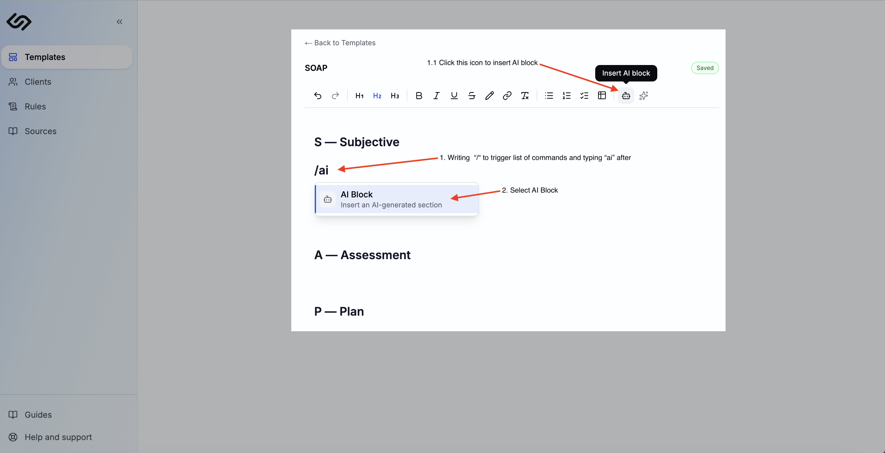 Slash menu open in the template editor with AI Block option highlighted